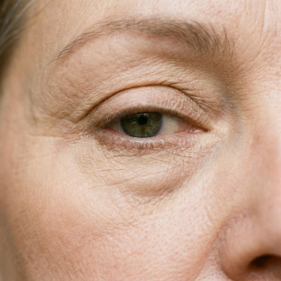 Concealer settled into fine lines under the eye