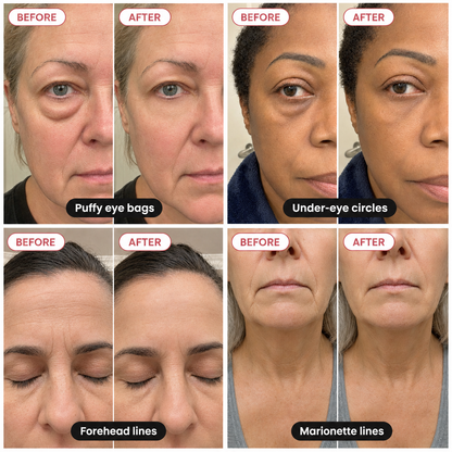 Soft-Set Eye Serum
